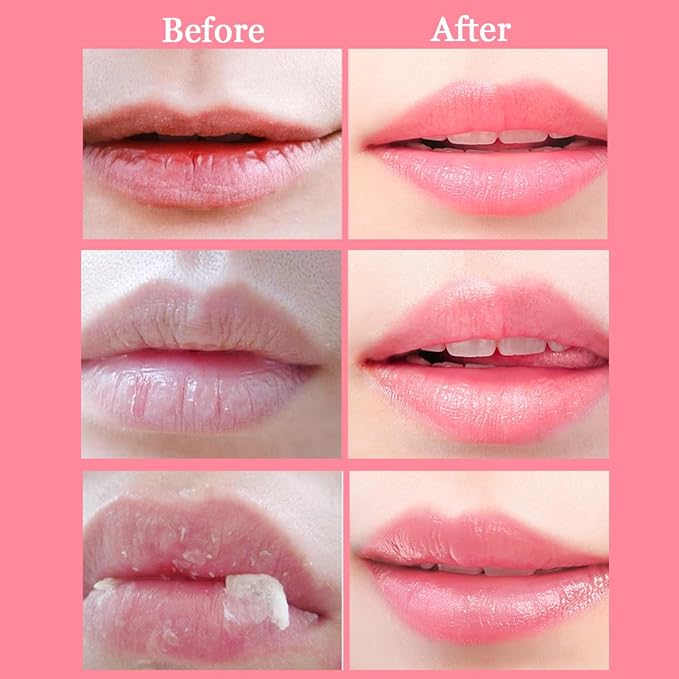 2 Pcs Bee Lip Balm Honey Pot, Honey & Strawberry Lip Mask Propolis Moisturizing - Image 7