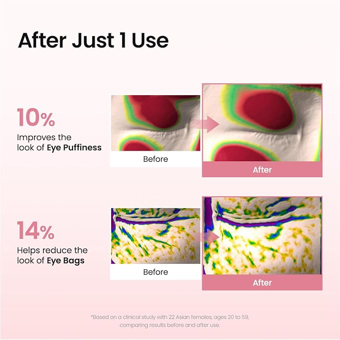 BIODANCE Collagen Peptide Eye Patches, Anti Wrinkle & Smile Line Patches - Image 5
