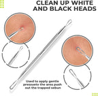 2 Pcs Pimple Extractor Tool 410 Grade Stainless Steel | Comedone Extractor - Image 6