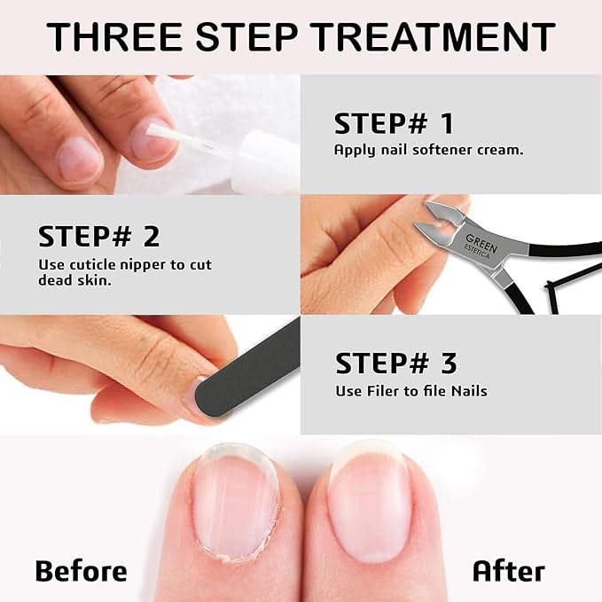 Professional Cuticle Trimmer Nail Cuticle Cutter Stainless Steel Cuticle Nippers - Image 6