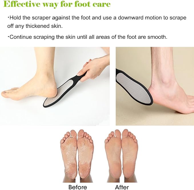BEZOX Foot File, Double Sided Foot Scraper Callus Remover, Foot Rasp - Image 5