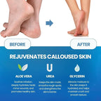 Imperial Feet Callus Softener Spray - Image 8