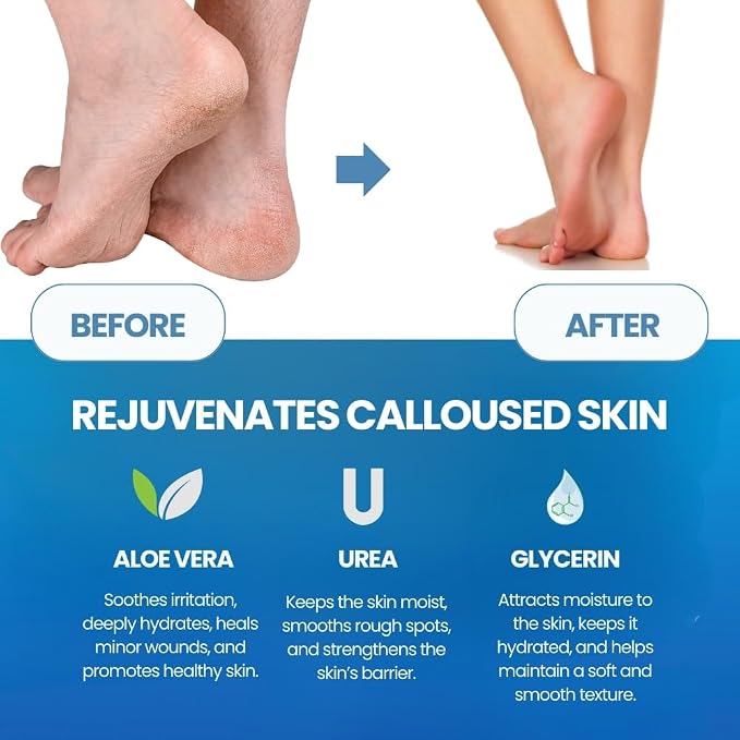 Imperial Feet Callus Softener Spray - Image 8