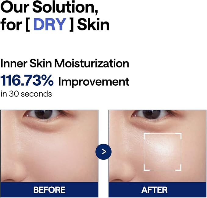 MEDIHEAL Toner Pads - Image 4