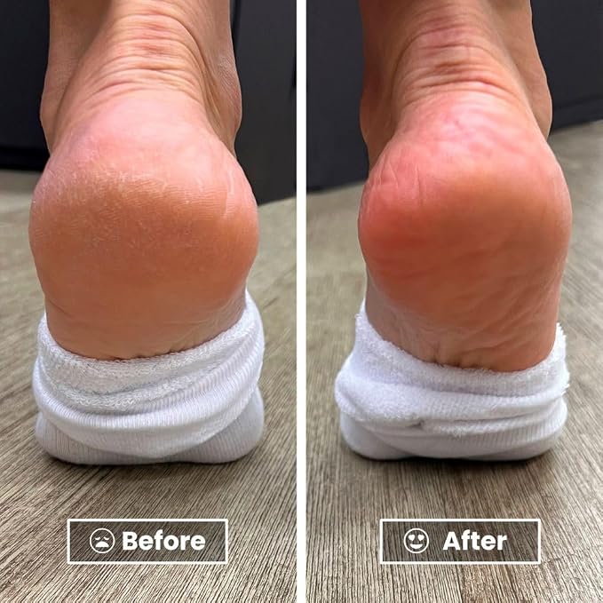 LONDONTOWN Pedikur Foot Balm Restorative Smoother Soles & Softer Heels - Image 3