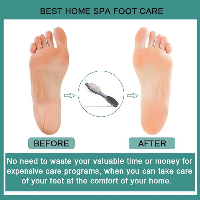 CAREHOOD Foot File Callus Remover - Image 6