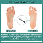 CAREHOOD Foot File Callus Remover - Image 6