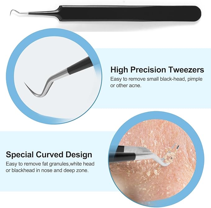Blackhead Remover Tools Pimple Popper Tool Kit, Comedones Extractor Acne - Image 3