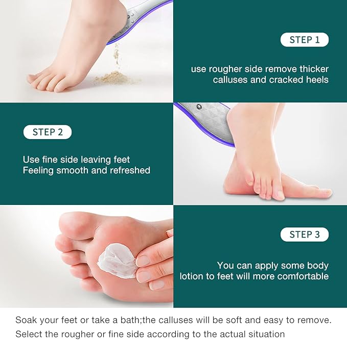 MR.GREEN Foot File Double Sided Pedicure Foot Care Tools Professional Callus - Image 4