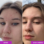 Good Molecules Niacinamide Serum Pack 2 – 30 ml Each | 10% Niacinamide Serum to - Image 4