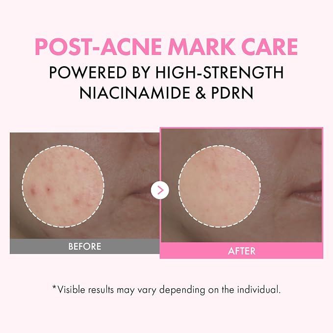 TOSOWOONG Pink PDRN Niacinamide Milky Toner, Niacinamide 5% Dark Spot Care - Image 2