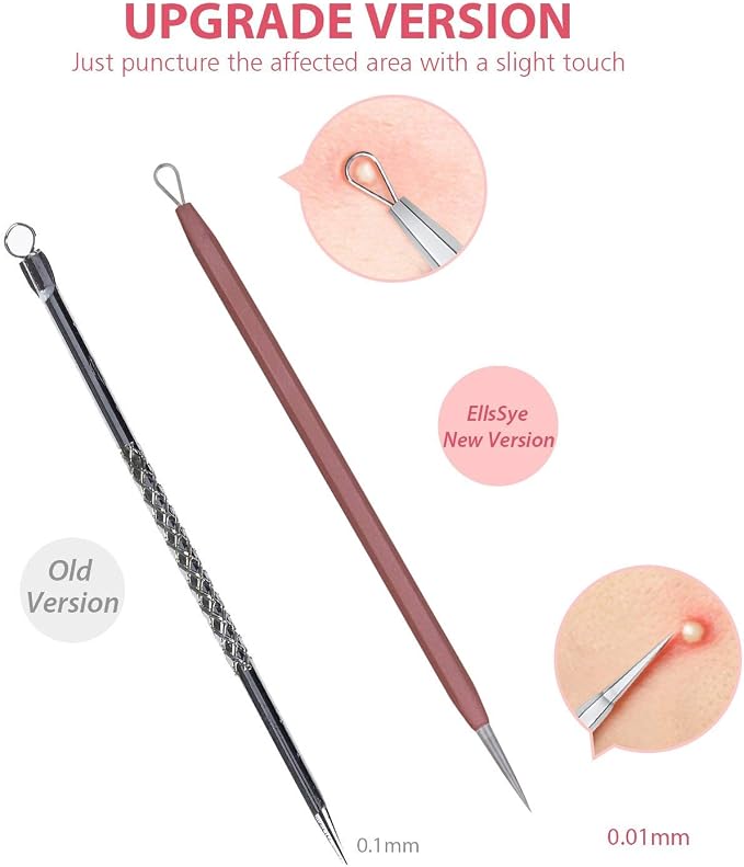 JPNK Blackhead Remover Tool Comedones Extractor Acne Removal Kit - Image 3