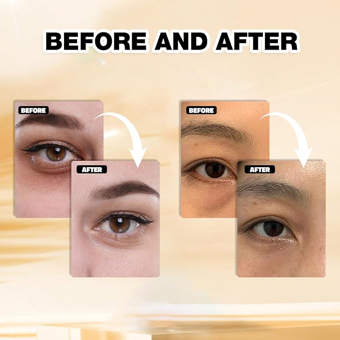 Gold Under Eye Masks – 24 Pairs Collagen & Hydrating Gel Eye Patches - Image 7