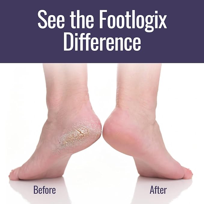 Footlogix Foot Care Callus Softener Combo - Image 4
