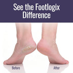 Footlogix Foot Care Callus Softener Combo - Image 4