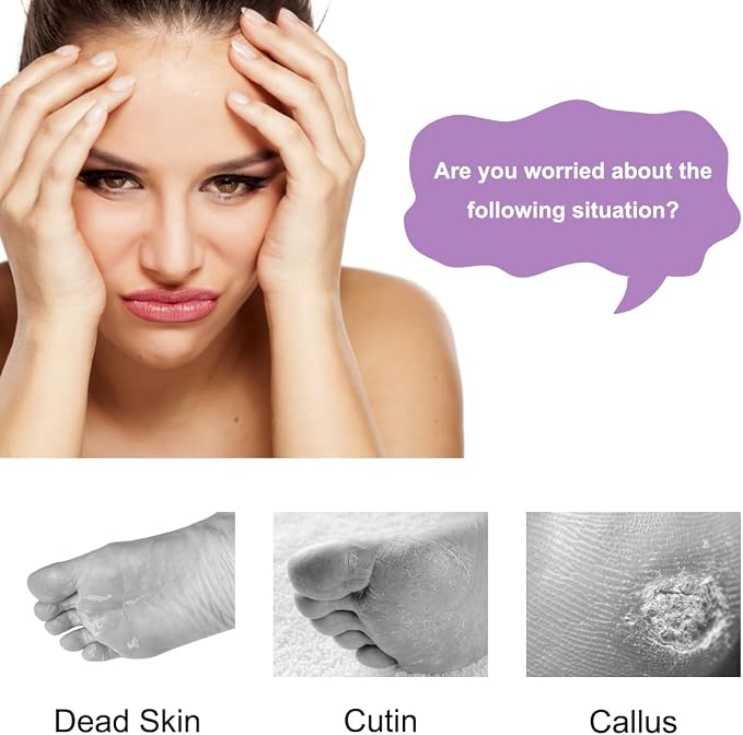 4-Pack 4 in 1 Pedicure Tool Callus Remover - Image 2