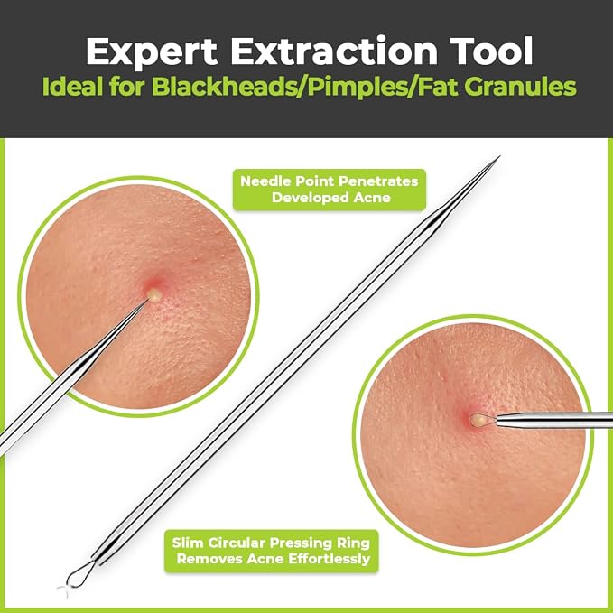 2 Pcs Pimple Extractor Tool 410 Grade Stainless Steel | Comedone Extractor - Image 3