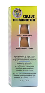 Mr. Pumice Callus Terminator 4oz - Image 2