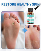 MQ Professional Corn & Callus Remover Liquid - Image 5