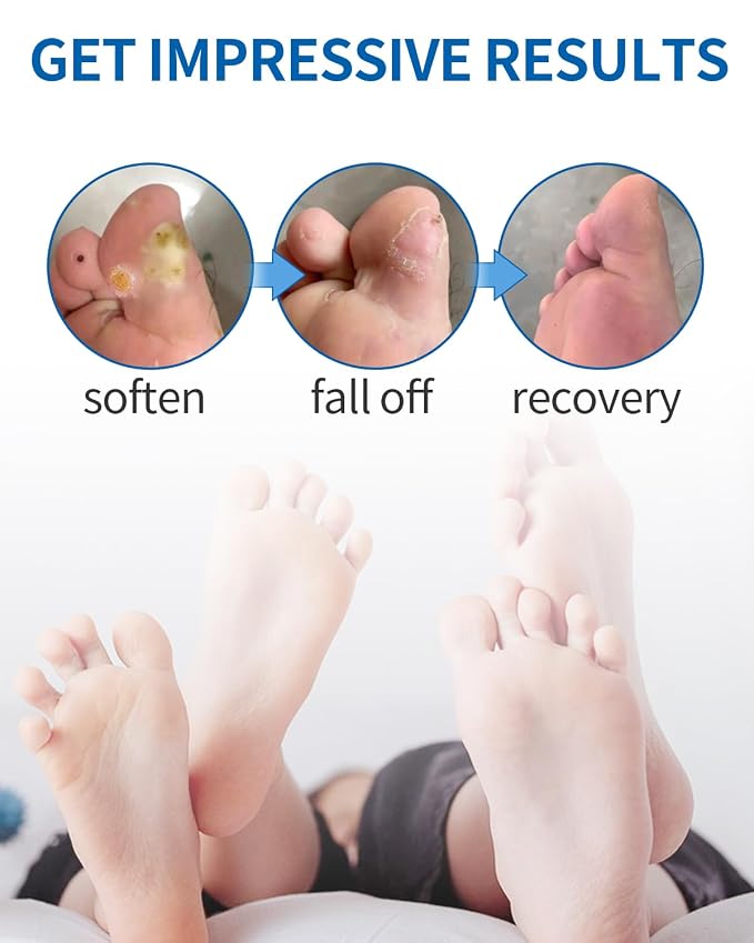 MQ Professional Corn & Callus Remover Liquid - Image 7