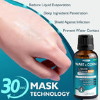 Wart Remover Freeze Off, Wart Corn Removers - Image 3