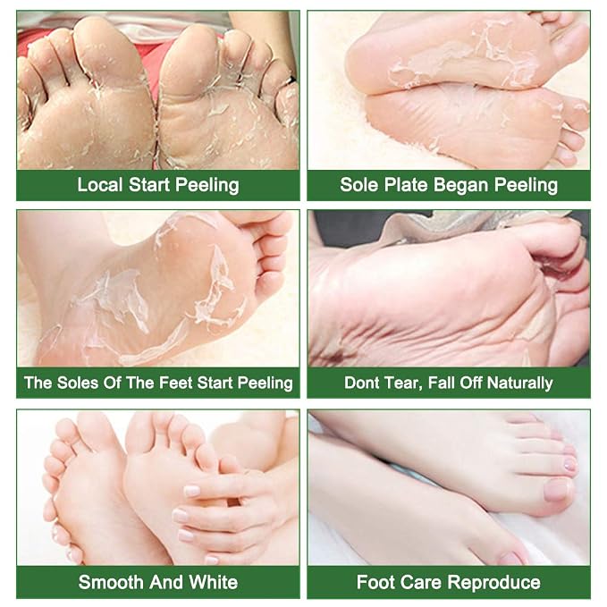 Liefiet Foot Peeling Mask 5 Pack, Foot Mask Remove Dead Skin, Rough Callus and - Image 2