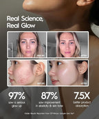 REVO Genie Facial Massager for Face and Neck, LED Face Lift Device - Image 3