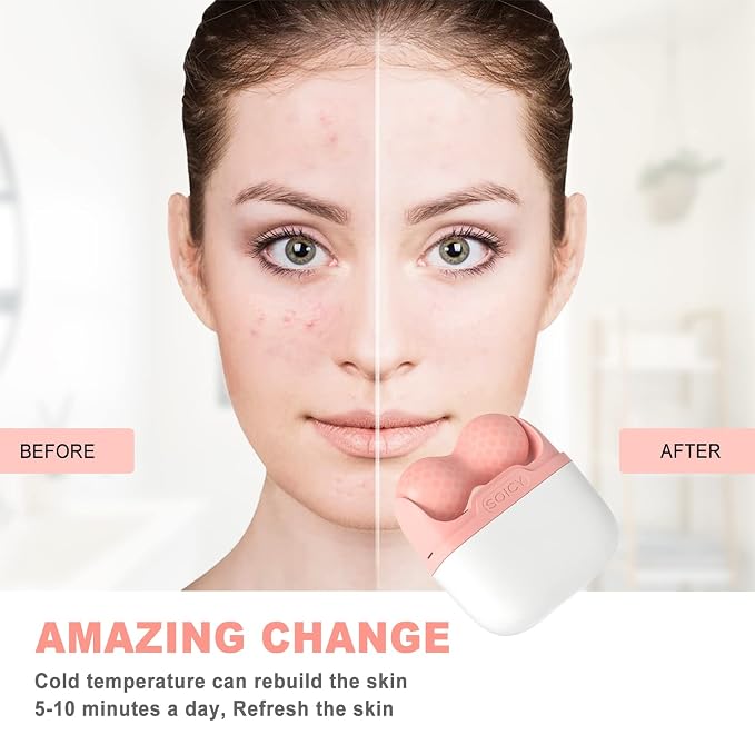 Ice Roller for Face and Eyes - Image 6
