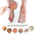 AM 8:00Pumice Stone Foot File, 2 Pack Callus Remover - Image 6