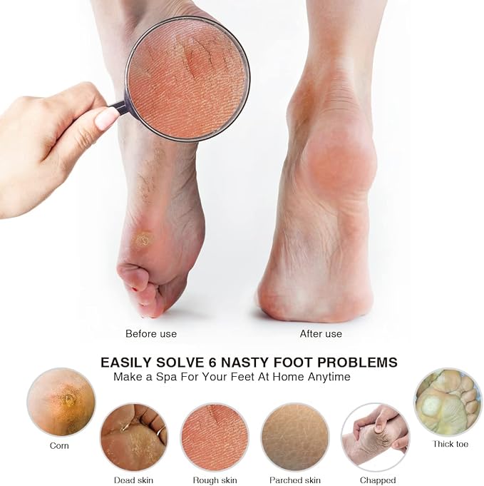 AM 8:00Pumice Stone Foot File, 2 Pack Callus Remover - Image 6