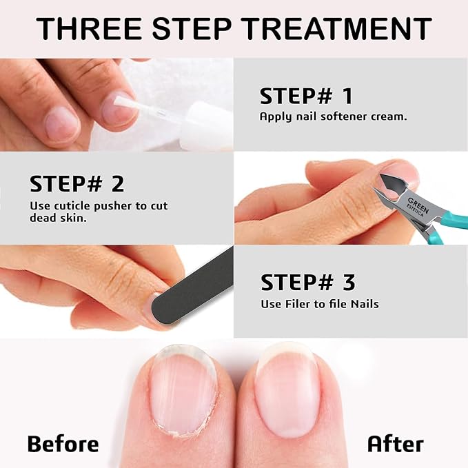 Professional Cuticle Trimmer Nail Cuticle Cutter Stainless Steel Cuticle Nippers - Image 8