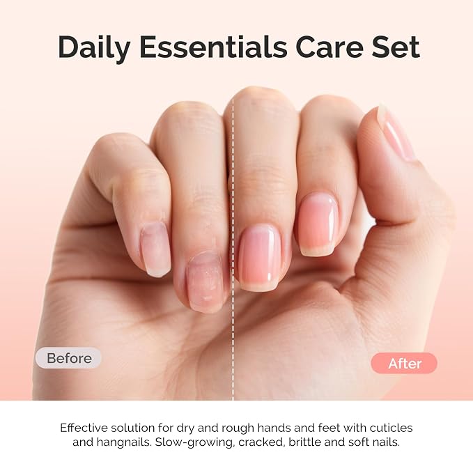 MelodySusie 25ML Cuticle Care Kit - Image 2