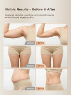 Lymphatic Drainage Massager & Anti Cellulite Massage Tool, - Image 4