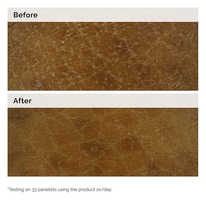 The Ordinary Natural Moisturizing Factors + Inulin Body Lotion, Lightweight - Image 7