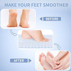 Yolife Shower Foot Scrubber Mat, Anti-Slip Bath Mat - Image 3