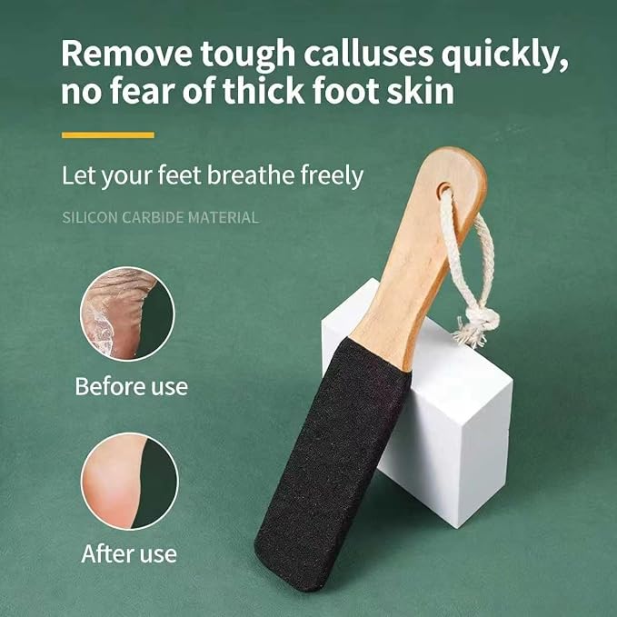 2-Pack Professional Pedicure Foot File - Image 3
