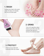 Electric Feet Callus Removers Rechargeable, Portable Electronic Foot File - Image 7