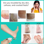 Foot File Callus Remover 5-in-1, Scrubber Brush, Stainless Steel Foot Rasp and - Image 3