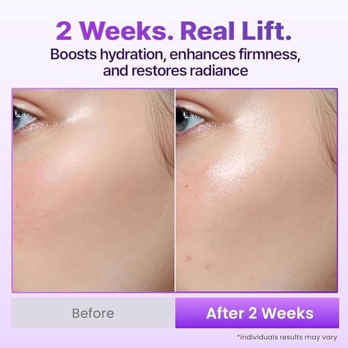 BIOHEAL BOH Probioderm 3D Lifting Cream Mist 3.38 fl oz | Korean Face Mist - Image 6