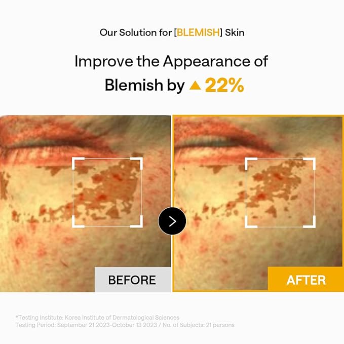Mediheal Vita Collagen Under Eye Patches for - Image 5
