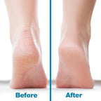 Probelle Double Sided Multidirectional Nickel Foot File Callus Remover - Image 5