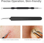 JPNK Blackhead Remover Tool Comedones Extractor Acne Removal Kit - Image 4
