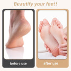 Electric Foot Callus Remover, Electronic Foot File, Portable Electric Callus - Image 9
