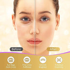 Under Eye Patches, 40 Pairs Eye Mask - Image 4