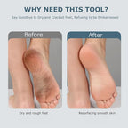 Upgraded Electric Foot Callues Remover, Portable Electric Foot Files - Image 8