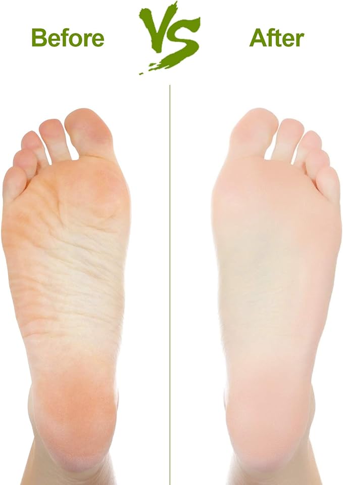 2PCS Natural Pumice Stone, Asqraqo Lava Pedicure Tools Hard Skin Callus Remover - Image 6