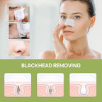 LANBENA Blackhead Remover - Image 4
