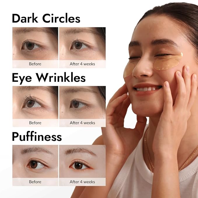 MIZON Under Eye Patches for Puffy Eyes & Dark Circles, 24K Gold & Snail Mucin - Image 2