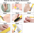Stainless Callus Removers Set Foot File Pedicure Tools Kit - Image 6