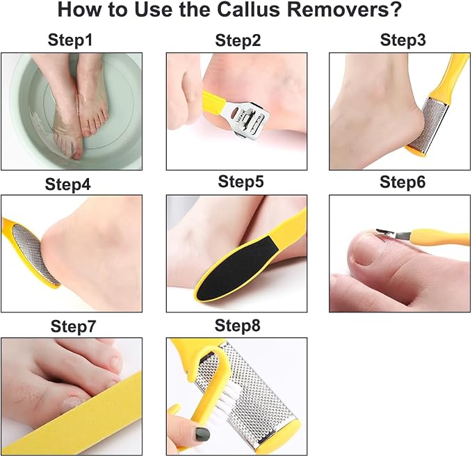 Stainless Callus Removers Set Foot File Pedicure Tools Kit - Image 6